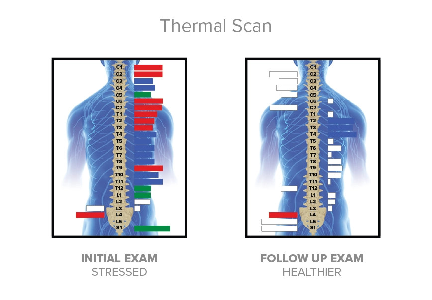 Chiropractic Edina MN Neurothermal Scans