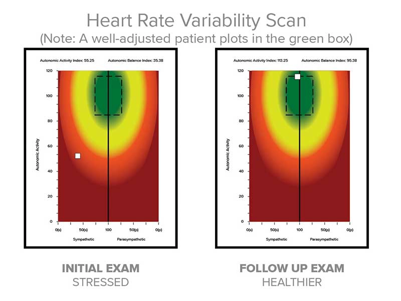 Chiropractic Edina MN Variability Scans